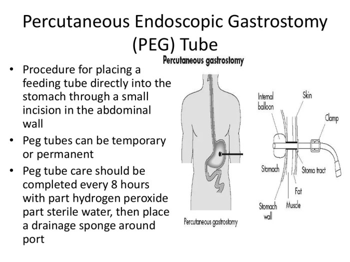 Spine surgery endoscopic laser discectomy treatment spinal lumbar disc endoscope open stenosis include singapore several systems types different there india